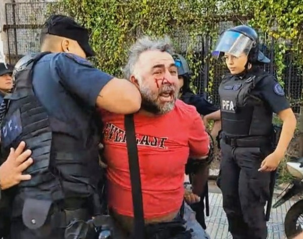 La Policía hirió y detuvo a un camarógrafo de A24 frente al Congreso